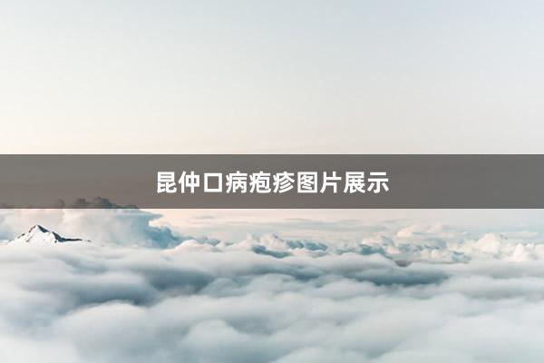 昆仲口病疱疹图片展示